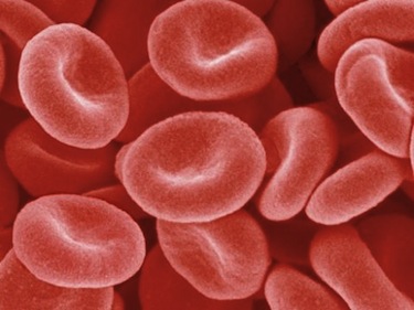 Here's what healthy red blood cells look like. Iron-deficiency anemia, which is more prevalent in Nunavut than in any other region of Canada, results when there’s not enough iron to make cells to bring oxygen around the body.