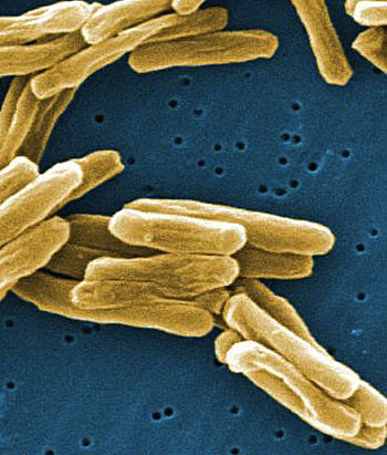 Infections of the bacteria that causes tuberculosis can lead to death in infected people — if they don’t receive a long course of antibiotic treatment.