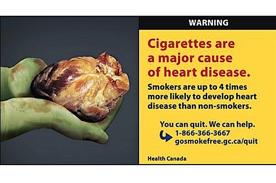 Tobacco companies will have to start selling revamped cigarette packages with images like this one by next June, federal health minister Leona Aglukkaq, also Nunavut's MP, announced Sept. 28. (HANDOUT PHOTO FROM HEALTH CANADA)