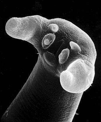 Meet Trichinella nativa, a parasitical worm that causes trichinosis. It can be found in the bodies of walrus, polar bear and other creatures. If you eat walrus meat that's not properly cooked, it will start living inside your body too. The symptoms of trichinosis include vomiting, fever, diarrhea, a rash, muscle pain and fatigue.