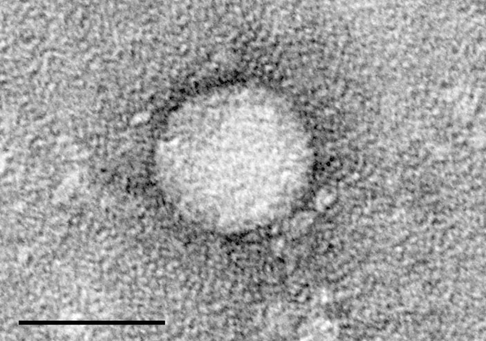 This image, derived from an electron microscope, shows the tiny virus that causes the hepatitis C liver disease. (PUBLIC DOMAIN IMAGE FROM WIKIMEDIA COMMONS)
