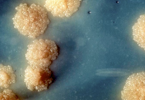 This is a close-up of a tuberculosis culture, showing the bacteria which still makes many Inuit in Canada ill. World TB Day falls March 24 each year, commemorating the day in 1882 when Dr. Robert Koch announced that he had discovered TB bacillus, the cause of the affliction. TB rates among Inuit remain the highest in Canada, with half of the active TB cases in Nunavut afflicting young people 15 to 34 years old, mainly from Iqaluit and Cape Dorset. In 2012, the Nunavik community of Kangiqsualujjuaq also dealt with a severe outbreak of TB. Read more about efforts to combat TB later March 25 on Nunatsiaqonline.ca. (PHOTO COURTESY OF THE CENTERS FOR DISEASE CONTROL AND PREVENTION)