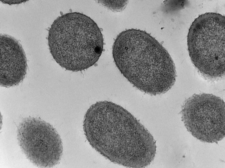 A microscopic look at one type of bacterium which naturally feasts on petroleum. (PHOTO COURTESY CHARLES GREER/NRC)