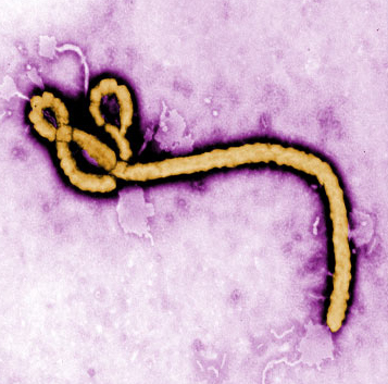 This handout image from the Centre for Disease Control and Prevention shows a close-up of the Ebola virus, which has infected more than 9,000 people in West Africa. (IMAGE COURTESY OF CDC)