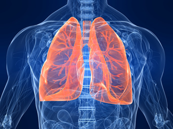 Tuberculosis, an infectious disease which affects the lungs, continues to impact Nunavik communities. New research links the origins of the TB strain to trading posts set up in the region in the early 20th century. (IMAGE COURTESY OF MCGILL)