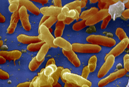 Nunavut health officials are now calling whooping cough “a serious and active health concern