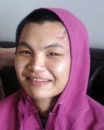 In one of the last photos taken of Mappaluk Adla alive, you can see the scar left behind after a jealous man attacked Adla with a metal pipe, fracturing his skull. (PHOTO COURTESY ETTULA ADLA)