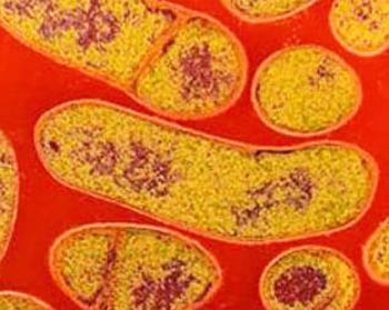 You can't taste it or see it, but botulism bacteria can kill you if they're in the meat you consume. (FILE PHOTO)