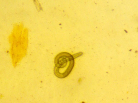 This is a photo taken through a microscope of a trichinella spiralis larvae after it has gone through artificial digestion. The larvae are similar to trichinella nativa, a parasite found in northern wildlife that causes illness to humans when eaten in raw meat.  (PHOTO BY DANIEL TAUKIE)